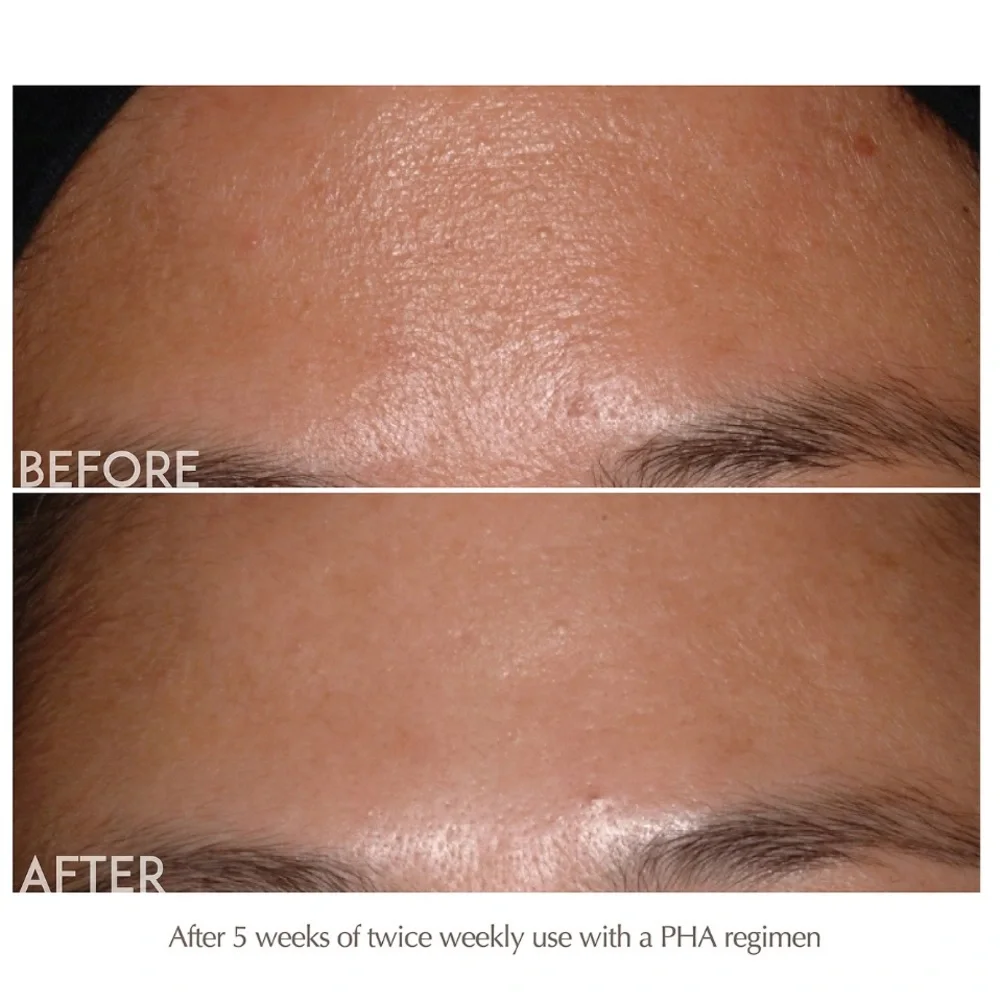 Exuviance Performance Peel AP25 13 Step 1&2 Pads At-Home Facial Peel NIB $86